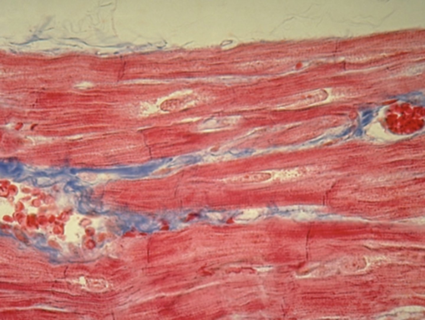 <p>Which of the three muscle tissue types is presented in the following image:</p>