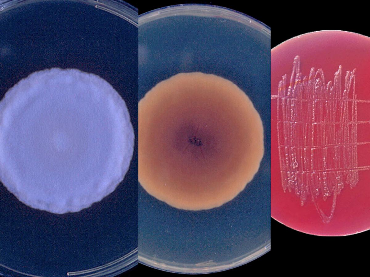 <p>Identify this fungus</p>