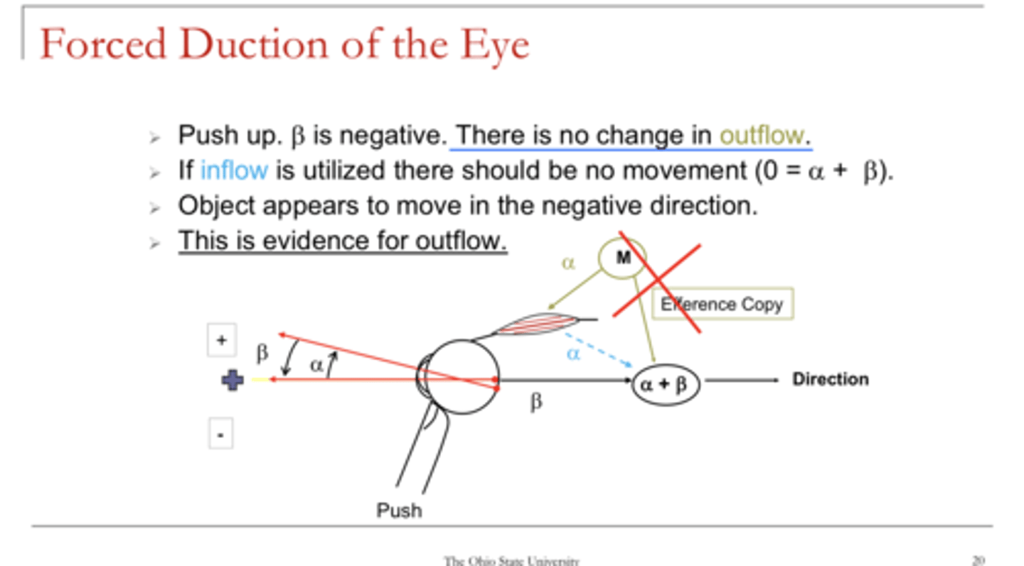 <p>The forced duction test is evidence for (outflow/inflow) theory</p>