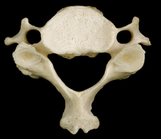 <p>what vertebrae is this</p>