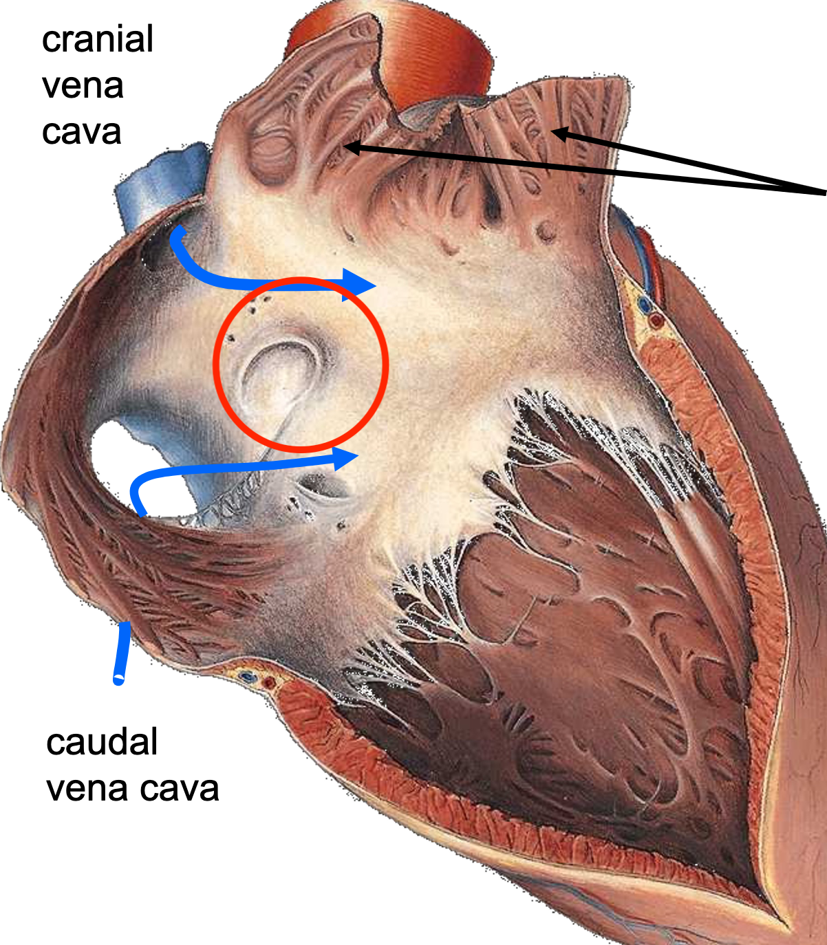 RED- in newborn hearts where there used to be a flap while in the stomach