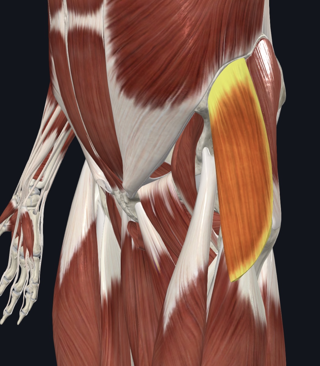 term image