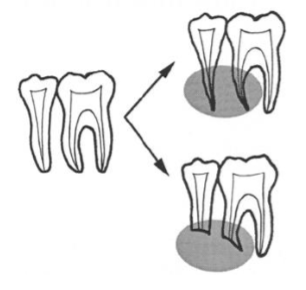 <ul><li><p>malignant: more likely to have thinning or “spiking” root appearance </p></li><li><p>benign: tend to have smooth borders or resorption continuous w lesion </p></li></ul><p></p>