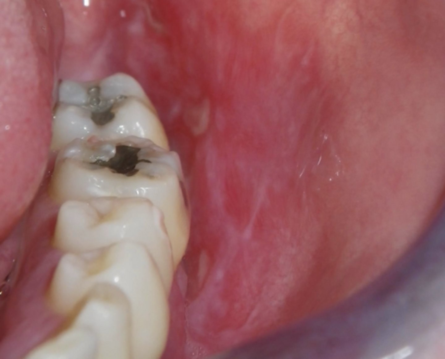 <p>What condition?</p>