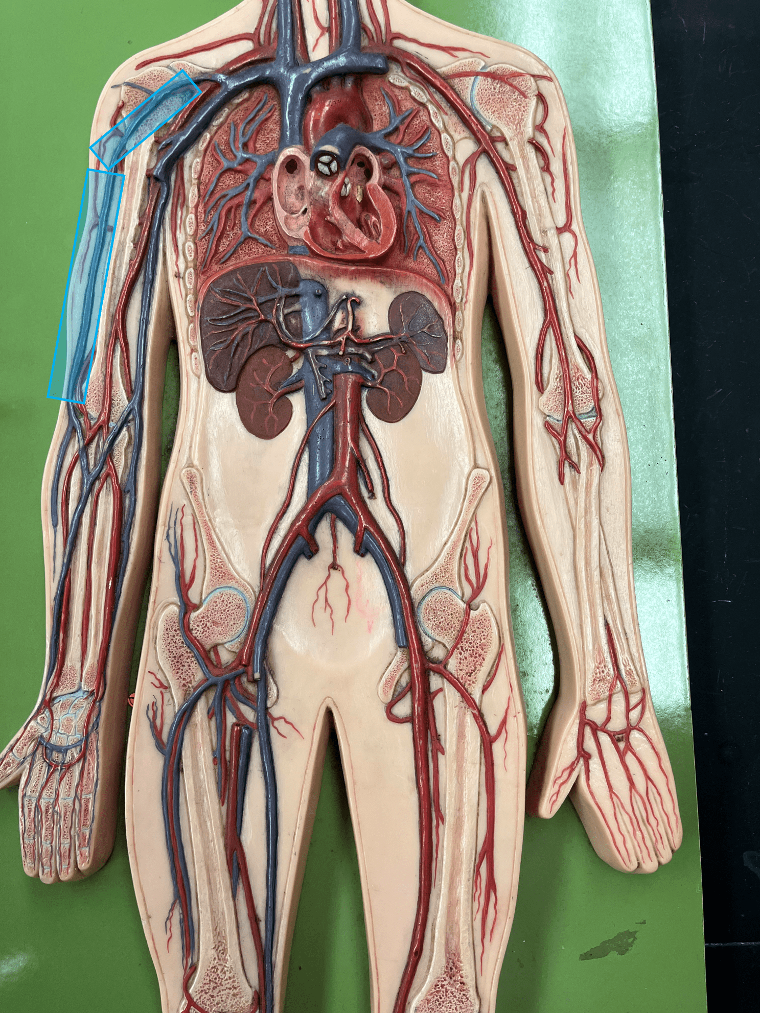 <p>• A vein of the upper limb.</p>
<p>• Drains the lateral arm.</p>
<p>• Empties into the axillary vein.</p>