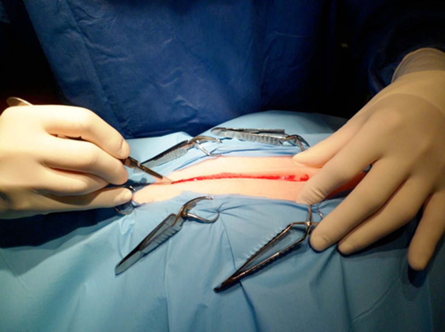 <p>process of cutting, incision</p>