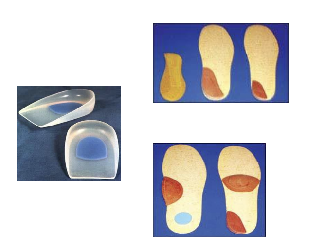 <p><span data-name="black_small_square" data-type="emoji">▪</span> Heel modifications</p><ul><li><p>Heel cushion</p></li><li><p>Heel wedges</p></li></ul><p></p><p><span data-name="black_small_square" data-type="emoji">▪</span> Sole modifications</p><ul><li><p>Metatarsal pad</p><ul><li><p>Scaphoid pad</p></li></ul></li></ul><p></p>