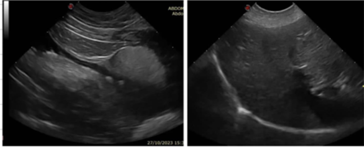 <p>these images were produced with what type of imaging?</p>