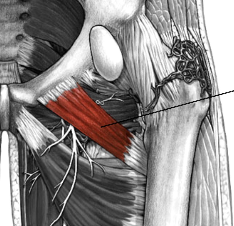 <p>Which muscle of the femur is:</p><ul><li><p>Superior to adductor brevis</p></li><li><p>Action: flex, adducts &amp; medial rot hip</p></li><li><p>Nerve: femoral</p></li></ul><p></p>