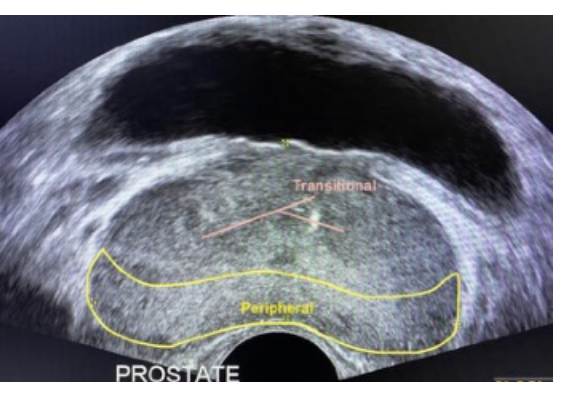 <p>Peripheral zone (also apical)</p>