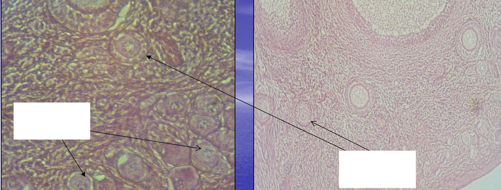 <p>What are the structures indicated by the rightmost box &amp; arrows?</p><p>*Hint: At this stage of follicular development, follicles will be grouped together near the ovarian free surface/germinal epithelium in clusters.</p>