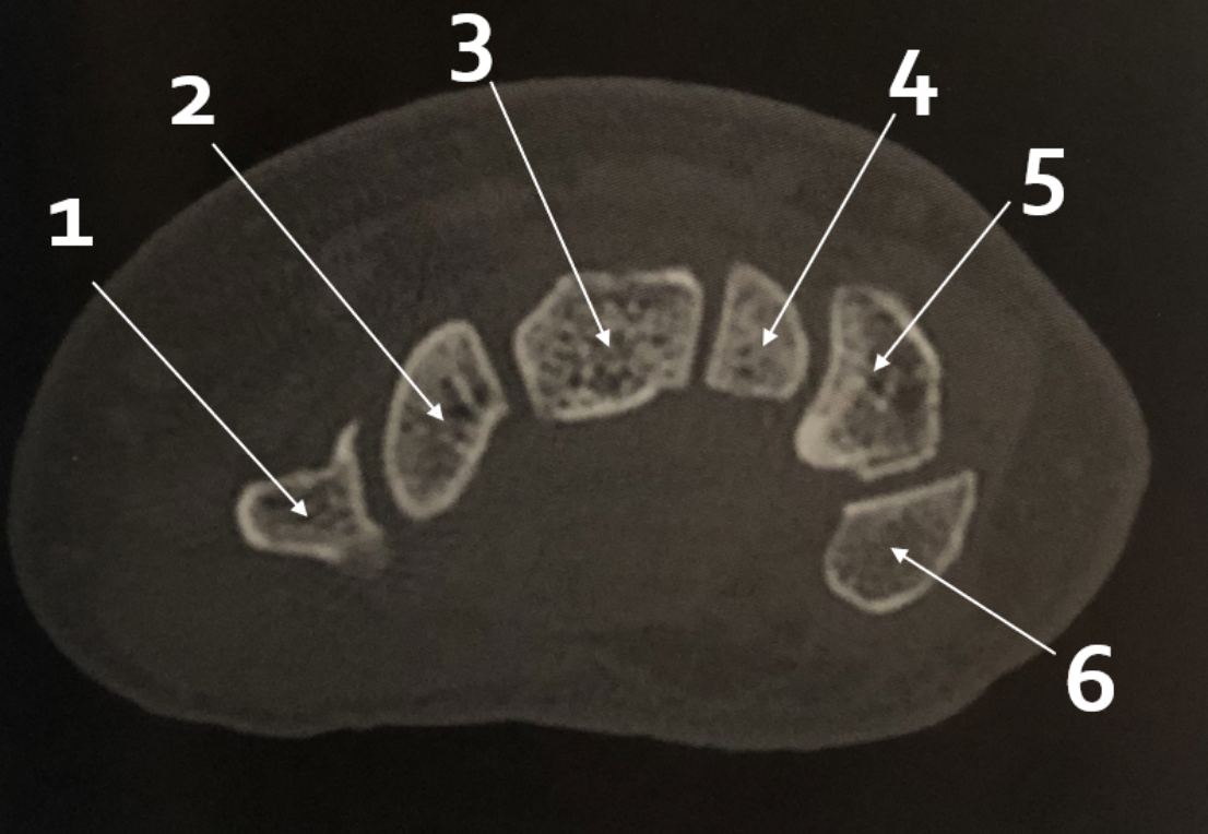 <p>5</p>