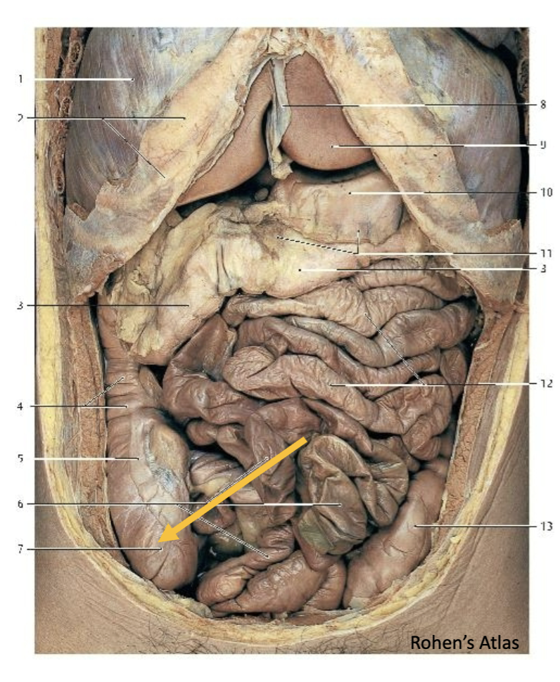 <p>The preganglionic parasympathetic neuron of the tagged structure is located in which of the following regions?</p>