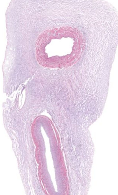 <p>note pink stained fibers</p>