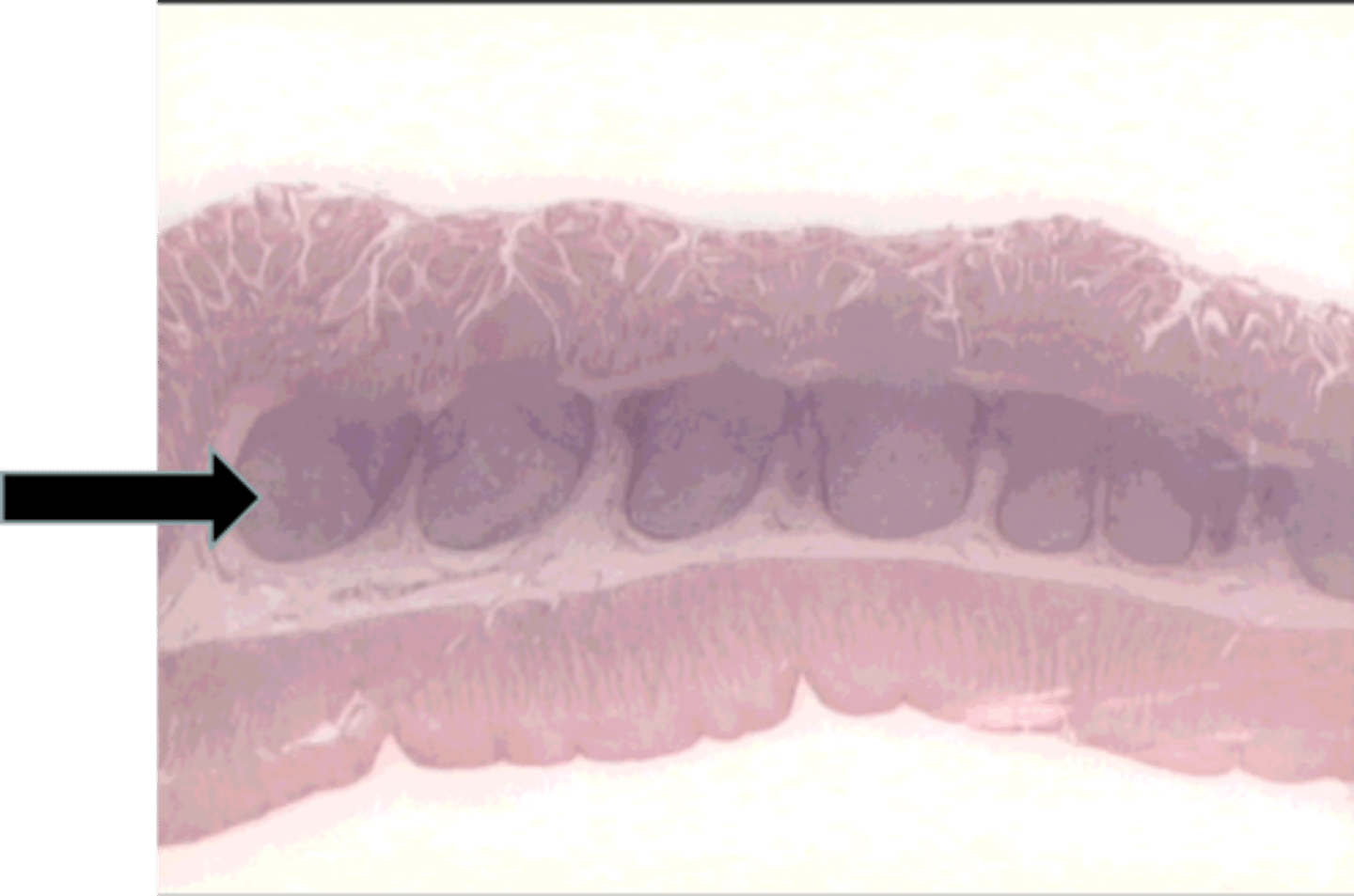 <p>black arrow</p><p>peyer's patches</p>