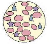 abnormal cell development