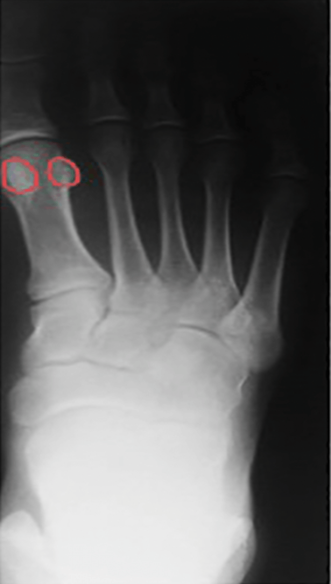 <p>What structure is highlighted?</p>