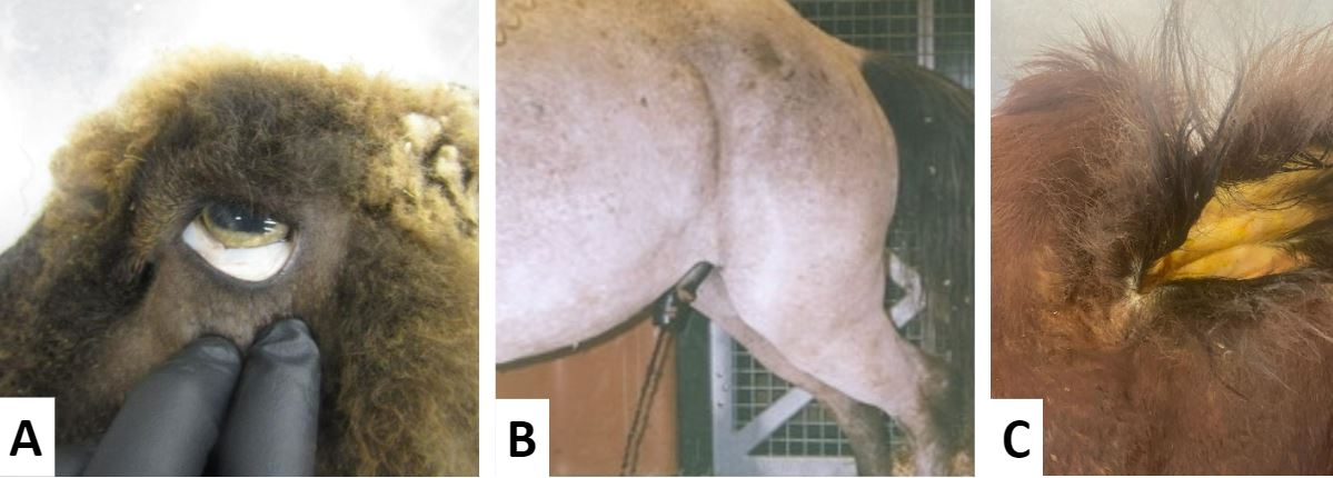 <p>Which of the following clinical findings is most specific for intravascular hemolysis?</p>