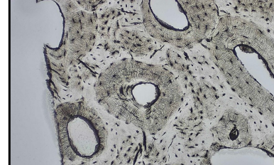 <p>Cells within the lacunae  </p>