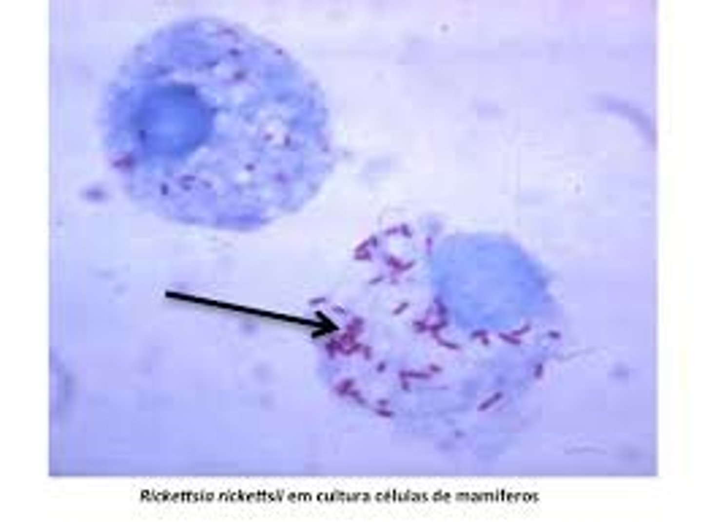 <p>(organy hodowane na zamówienie) - Lab-grown organs created specifically for transplantation into patient</p>