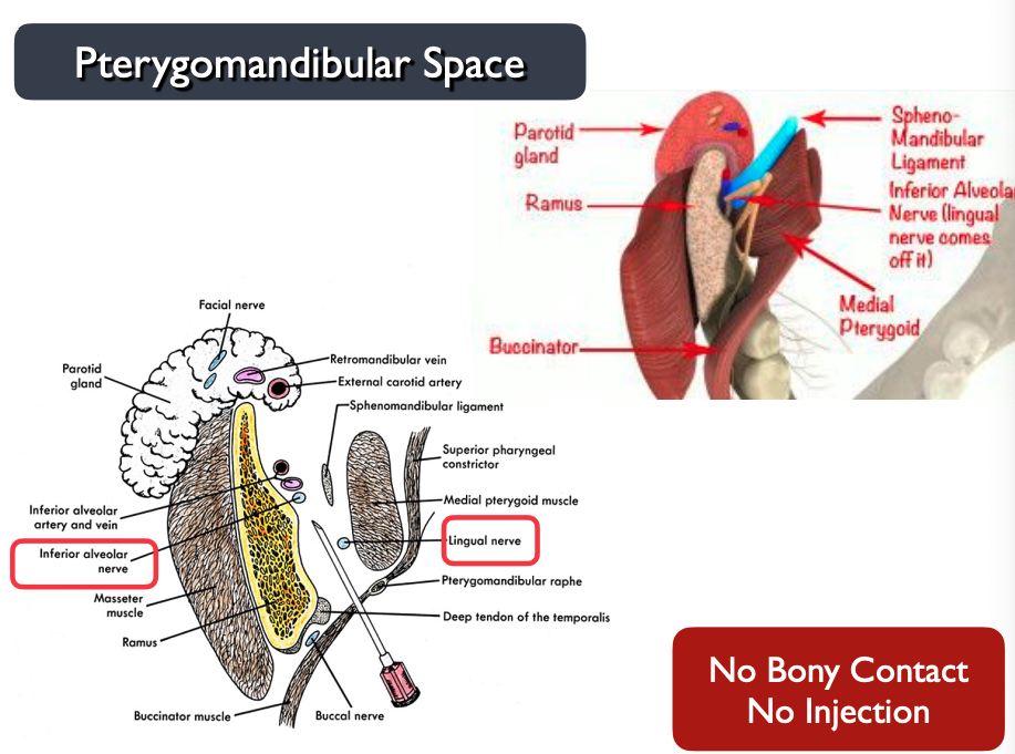 <p>parotid gland is right behind inferior alveolar nerve → anesthetize facial nerve → facial paralysis</p><img src="https://knowt-user-attachments.s3.amazonaws.com/e3fc0fa1-09ce-4e2f-ba85-df79d8b361e6.png" data-width="100%" data-align="center"><p></p>
