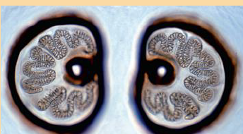 <p>This spiracle belongs to which fly larvae?</p>