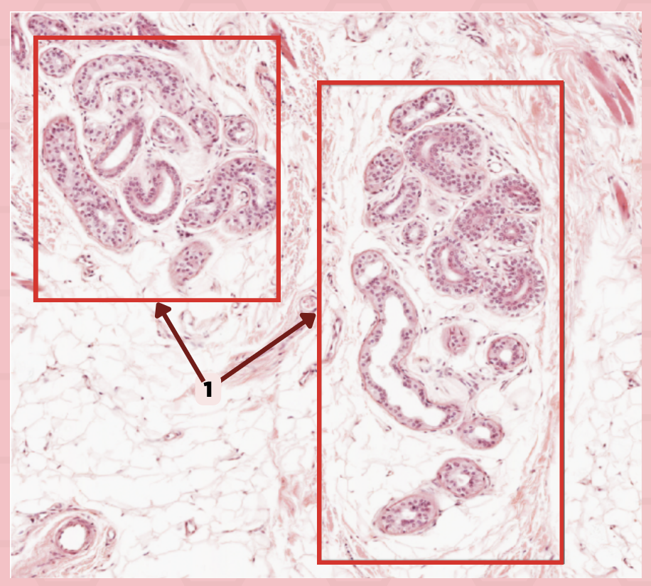 <p>Identify where the structure is located?</p><p>a. Epidermis of thin skin</p><p>b. Dermis of thin skin</p><p>c. Epidermis of thick skin</p><p>d. Dermis of thick skin</p>