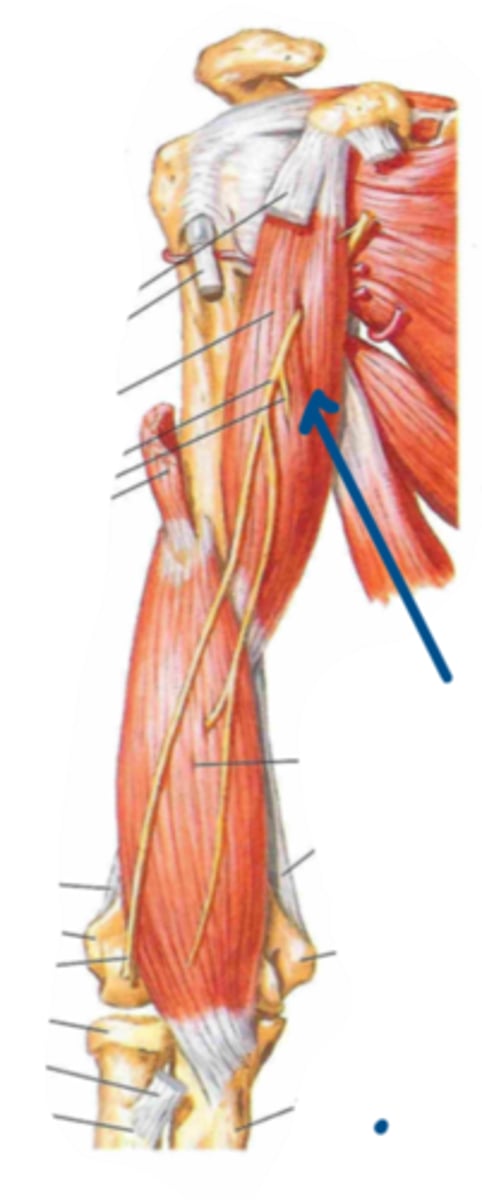 <p>Identify the insertion of the structure indicated by the arrow</p>