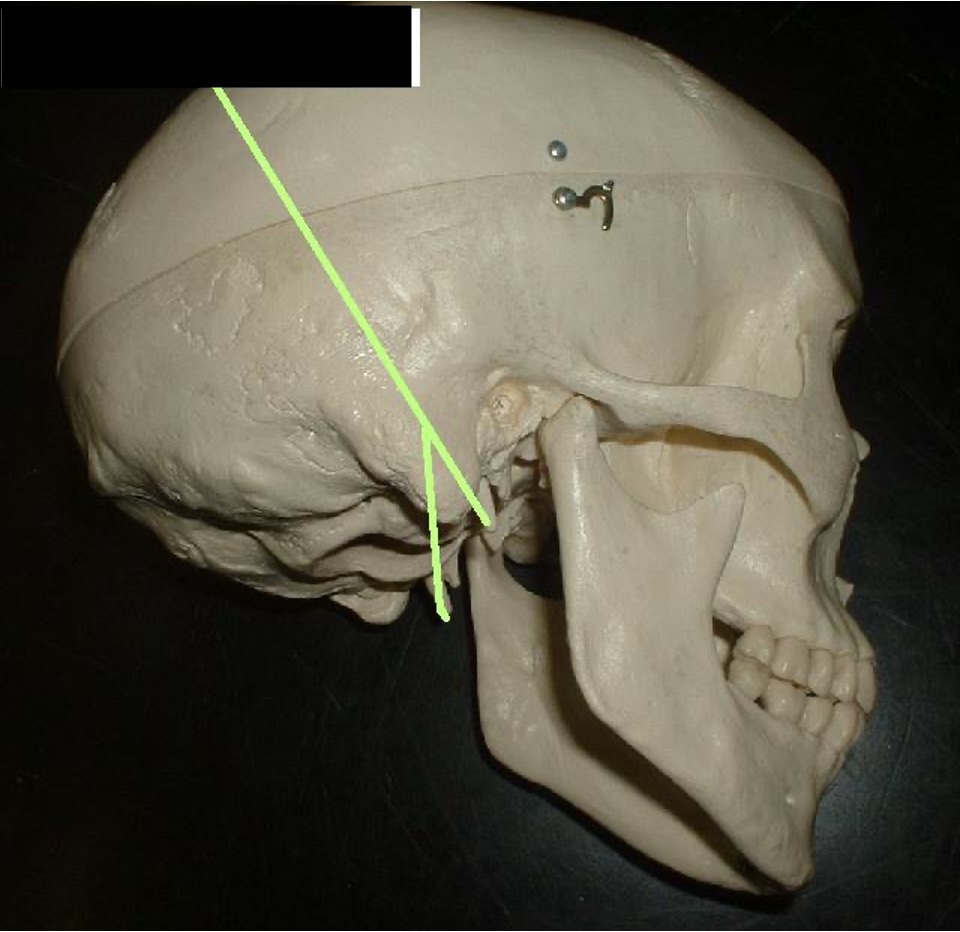 <p>it looks like fangs on the inside of the mastoid process</p>