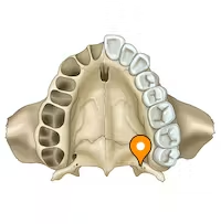 <p>posterolateral corner</p><p>lesser palatine nerves</p>