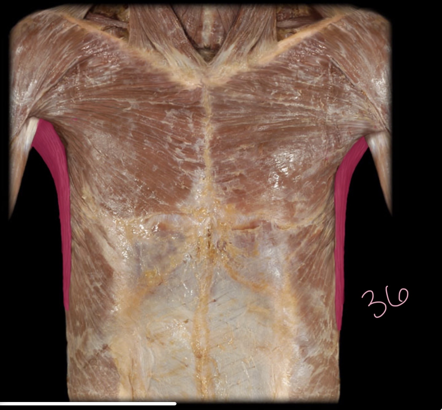 <p>Latissimus Dorsi</p>