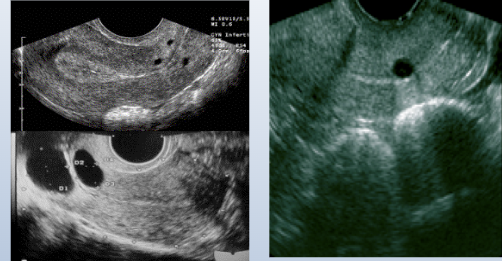 <p>what do these images show?</p>
