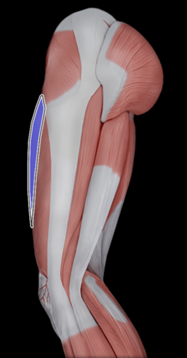 <p>What Muscle Is Highlighted?</p>