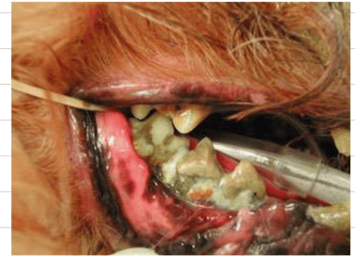 <p>what is this condition?</p>