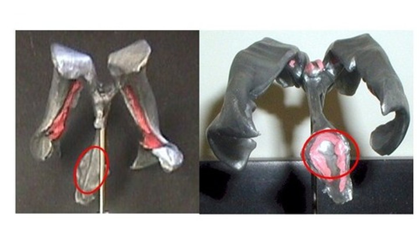<p>the ventricle located between the cerebellum and brainstem, connecting to the subarachnoid space via lateral foramina of Luschka and medial foramina of Megendie for CSF distribution</p><p>*connects spinal cord to central canal</p>