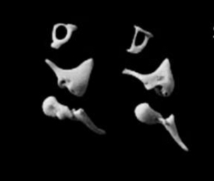 <p>Identify the auditory ossicles </p>