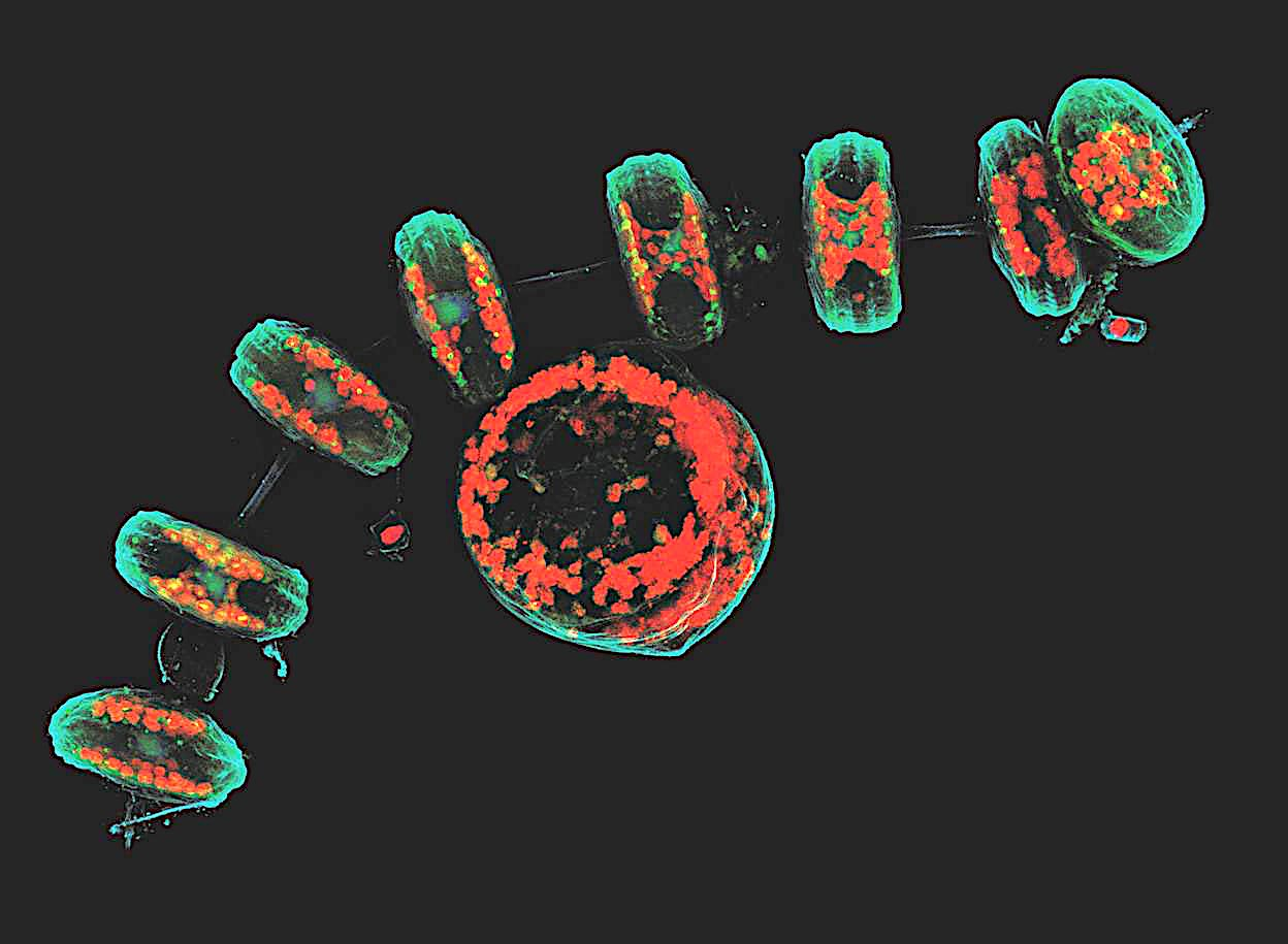 <p>Optical sectioning and reconstruction microscopy.</p><p>Capable of pinpointing fluorescence-tagged internal mechanisms of living specimens using a focused laser beam to scan the specimen point by point, creating high-resolution 3D images.</p><p>This technique enhances contrast and provides three-dimensional images by capturing multiple optical sections at different depths using a pinhole aperture to eliminate out-of-focus light, combined with a computer to reconstruct the images recorded by the laser scanner.</p><p>Can trace things but at a limited speed</p>