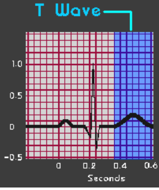 <p><strong>T Wave</strong></p><p>-Ventricular ____________, which is the return of stimulated muscle to _______ state</p><p>-Before the next cardiac cycle can begin</p>