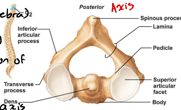 <p>Cervical vertebrae 2. Resemble more like c3-c7 (typical vertebrae) except for the fact that it has dens or odontoid process projecting superiorly from its body. </p><p>The dens act as a pivot for the rotation of the atlas, as a result allowing you to move head side to side.</p><p>Dens are the “missing” body from the atlas, which fuses with the axis during embryonic development.</p>