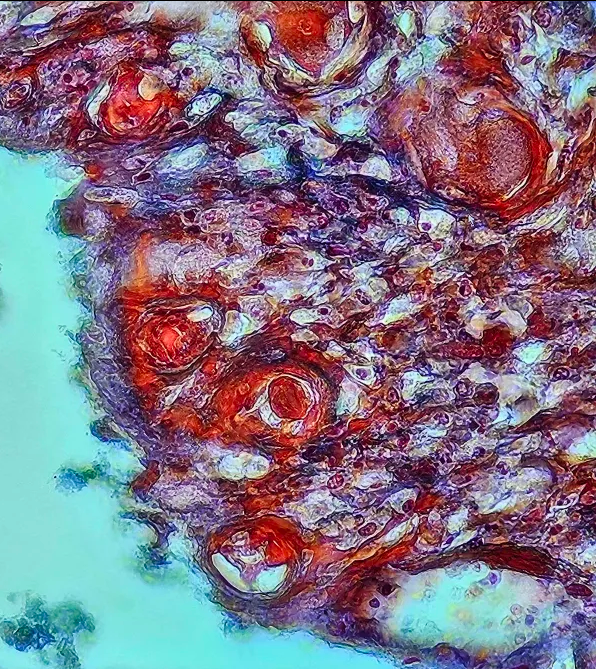 <p><span data-name="microscope" data-type="emoji">🔬</span><span data-name="petri_dish" data-type="emoji">🧫</span><strong><span> </span>Na podstawie zdjęcia preparatu:</strong></p><p></p><ul><li><p><span data-name="book" data-type="emoji">📖</span><span> </span>rozpoznaj gatunek pasożyta;</p></li></ul><p></p><ul><li><p><span data-name="recycle" data-type="emoji">♻</span><span> </span>rozpoznaj wszystkie formy rozwojowe;</p></li></ul><p></p><ul><li><p><span data-name="microbe" data-type="emoji">🦠</span><span> </span>wskaż organelle i cechy charakterystyczne dla danego gatunku;</p></li></ul><p></p><ul><li><p><span data-name="mask" data-type="emoji">😷</span><span> </span>nazwij chorobę, którą pasożyt wywołuje.</p></li></ul><p></p>