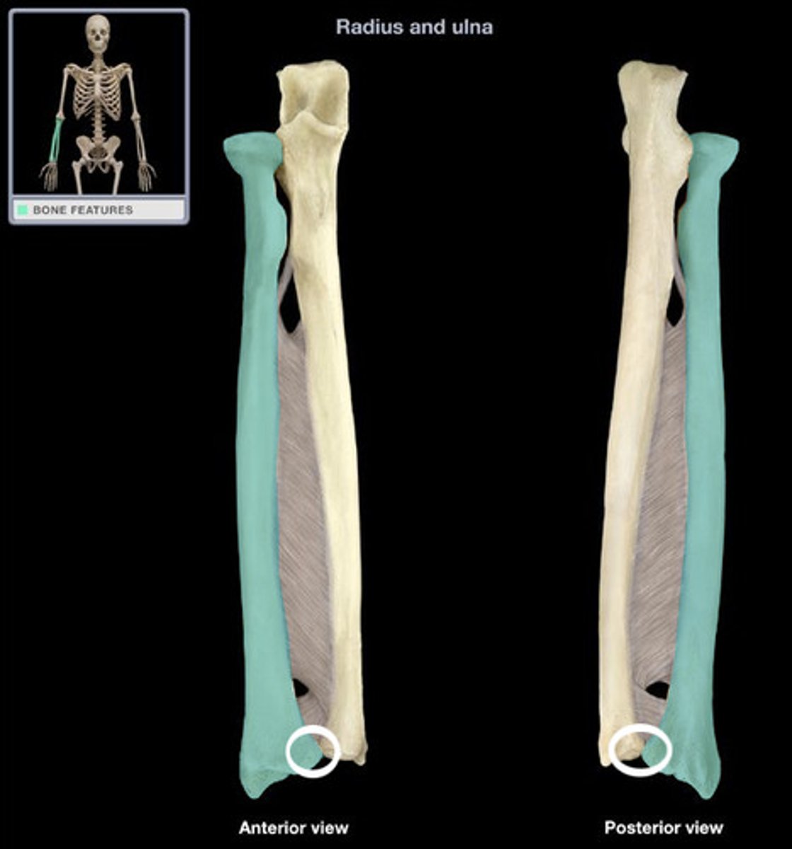 <p>Distal end (towards the hands), articulates with the ulnar</p>