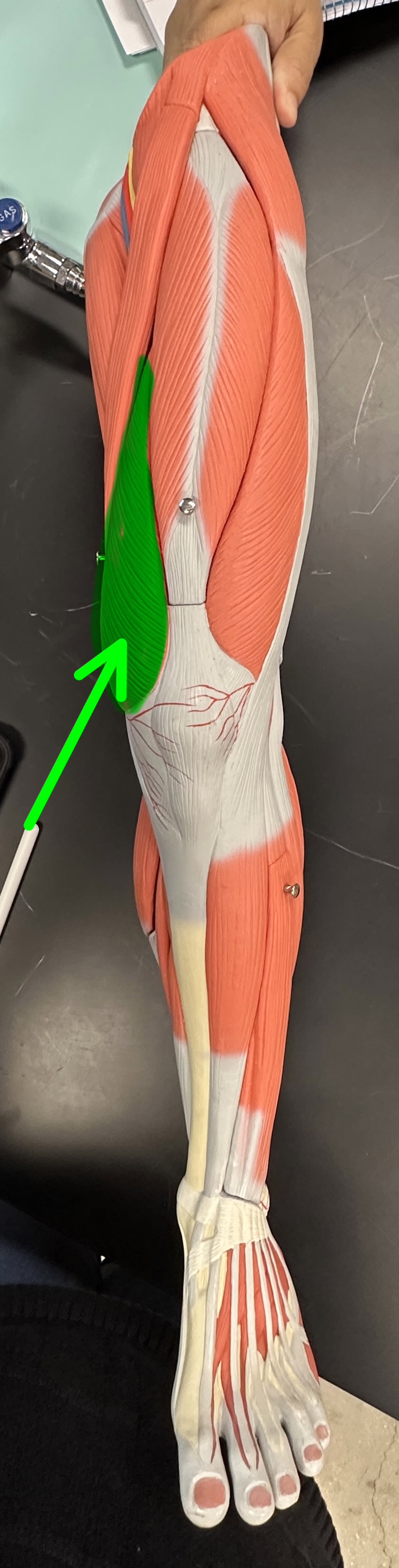 <p>What is the highlighted structure</p>