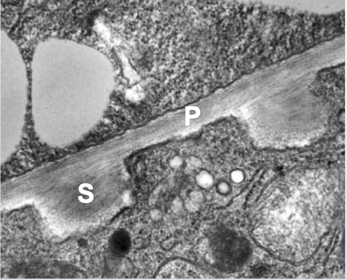 <ol><li><p><span style="font-family: sans-serif">Primary cell walls</span></p></li><li><p><span style="font-family: sans-serif">Secondary cell walls</span></p></li></ol>