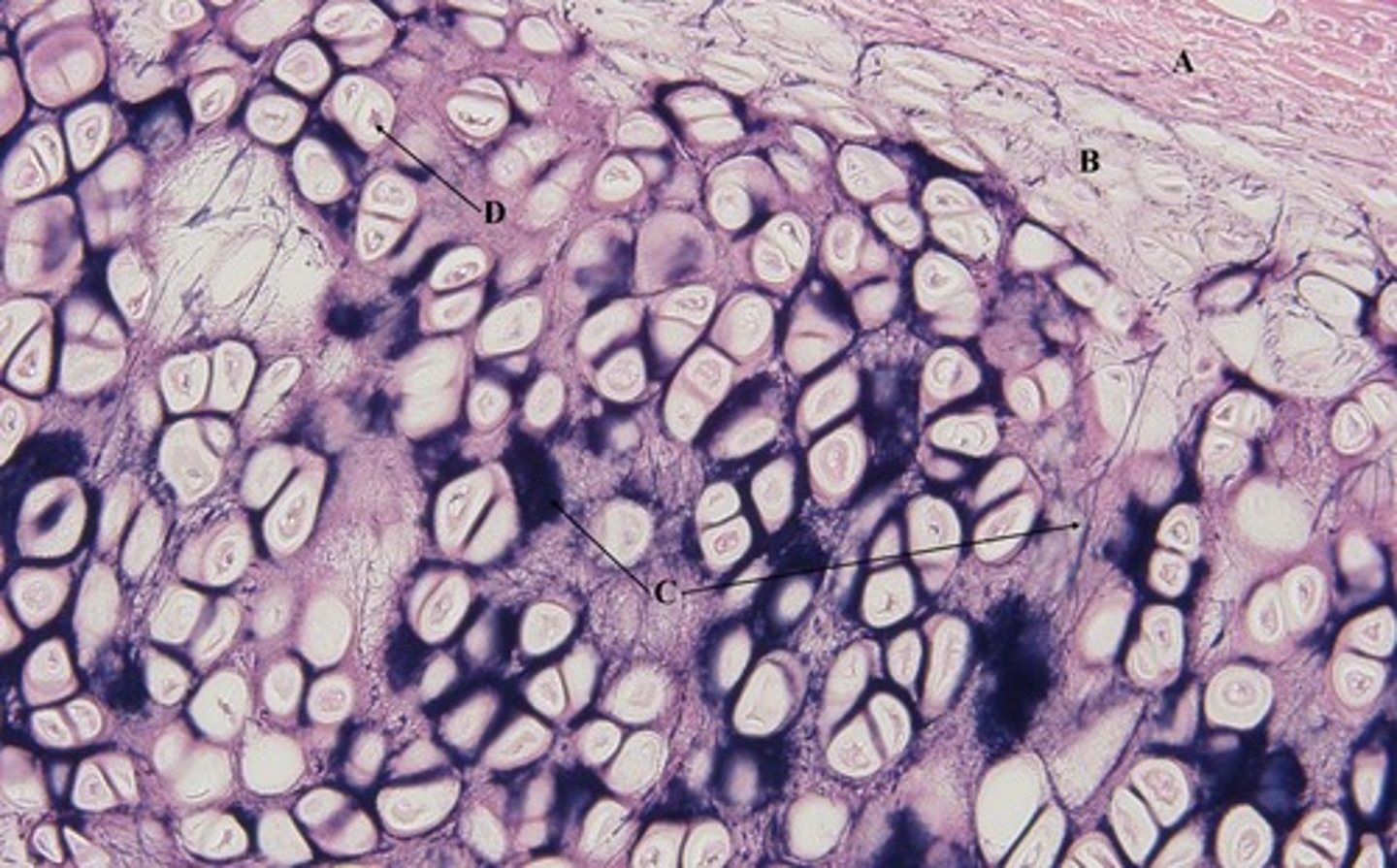 <p>cartilage with abundant elastic fibers; more flexible than hyaline cartilage; provides elasticity, location is external ear and epiglottis</p>