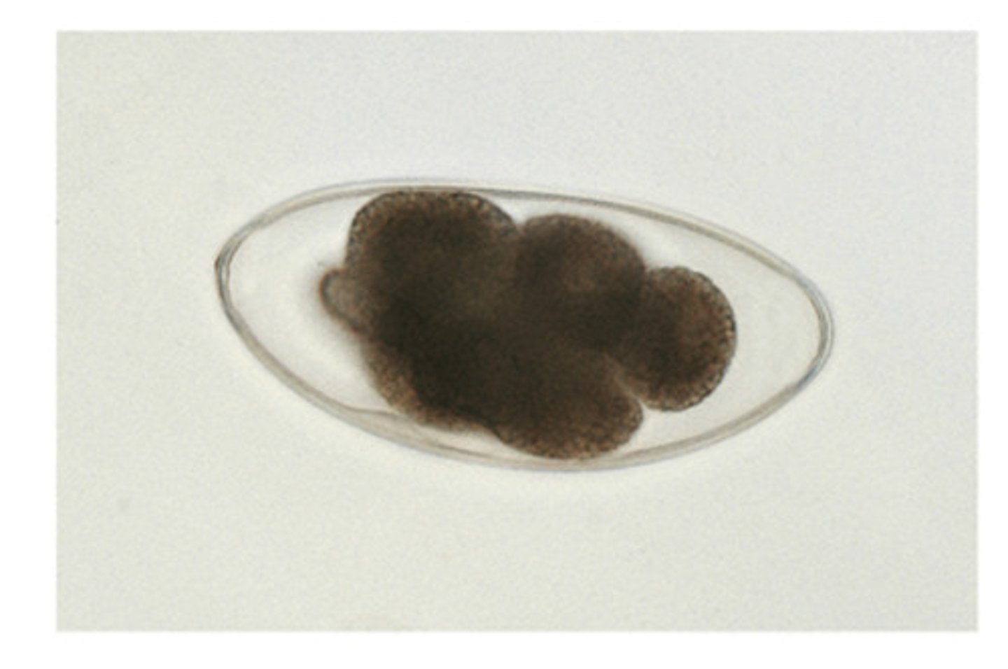 <p>The largest trichostrongyle egg of ruminant nematodes</p>