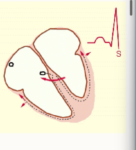 <ul><li><p>ventricular muscle repolarises, resetting electrical charge after contraction in preparation for the next heartbeat</p></li></ul><p></p>
