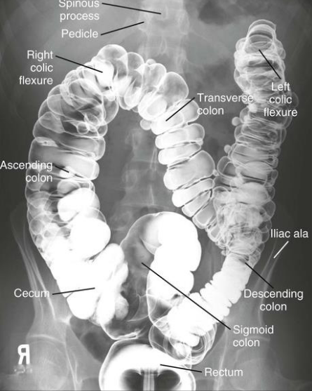 <p>Large Intestine: Is this Image Good?</p>