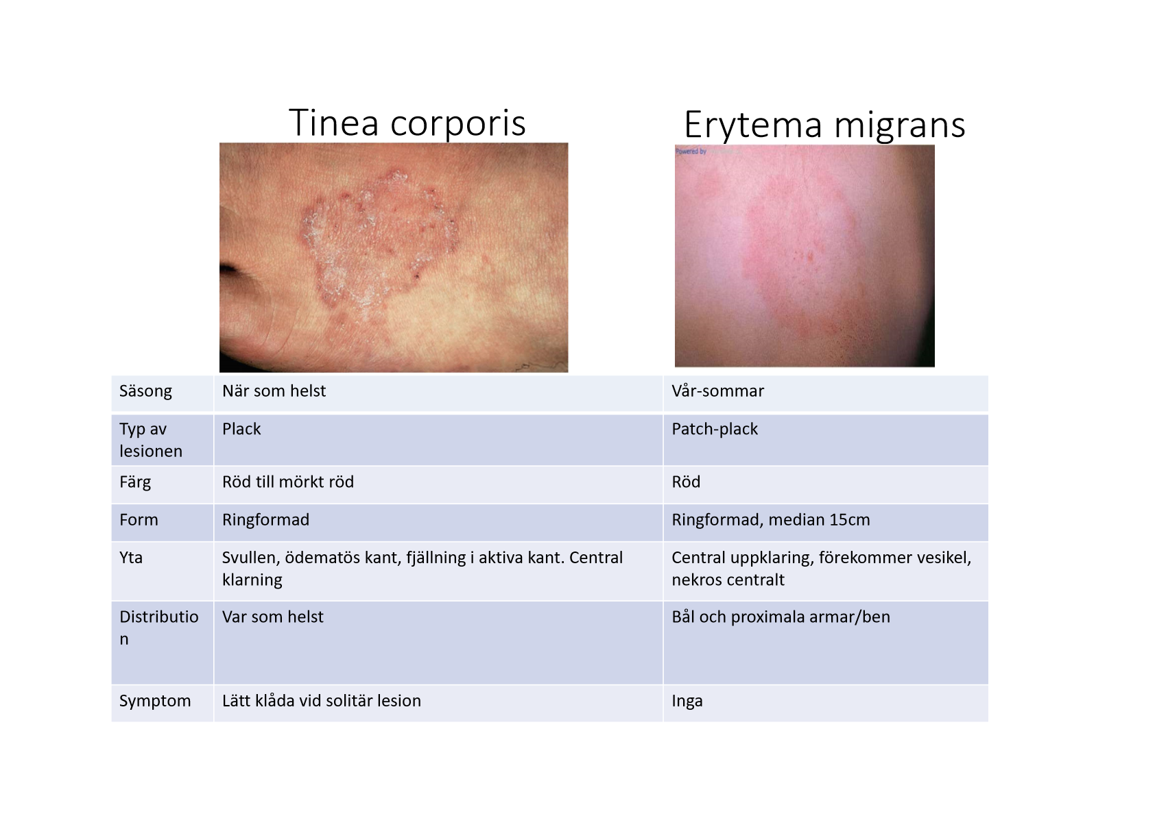 <ul><li><p>Tinea corporis viktigast!</p><ul><li><p>Svampinfektion i huden</p></li><li><p>Ringformad, växande</p></li><li><p>Fjällning och torr yta (svampinfektion)</p></li><li><p>Lite upphöjd kant av ringen</p></li><li><p>Lätt klåda</p></li></ul></li></ul><p></p>