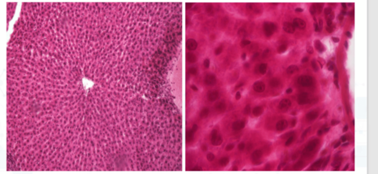 <p>hematoxylin (pink)</p>