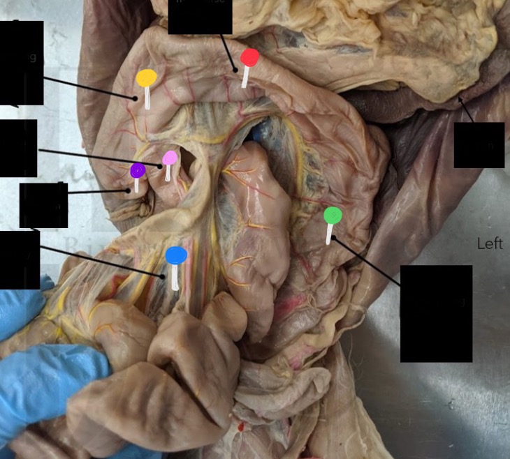 <p>What’s the pink pin </p>